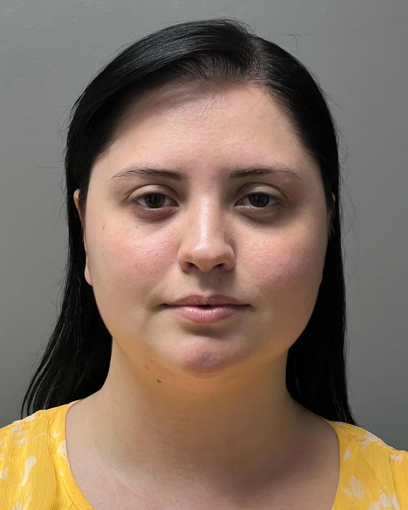 Chin Liposuction Before & After Image