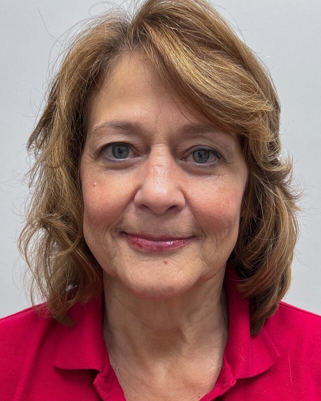 Facelift Before & After Image