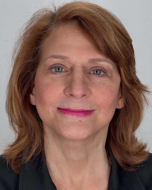 Facelift Before & After Image