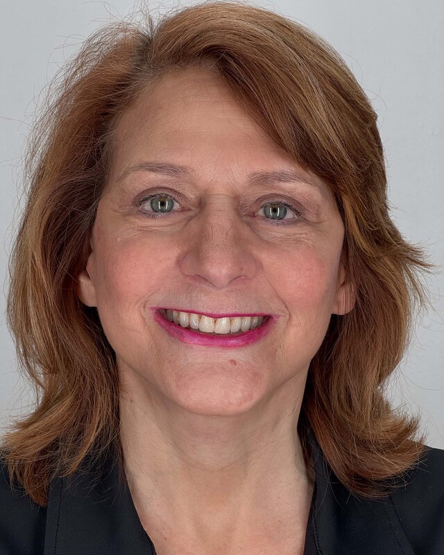 Facelift Before & After Image