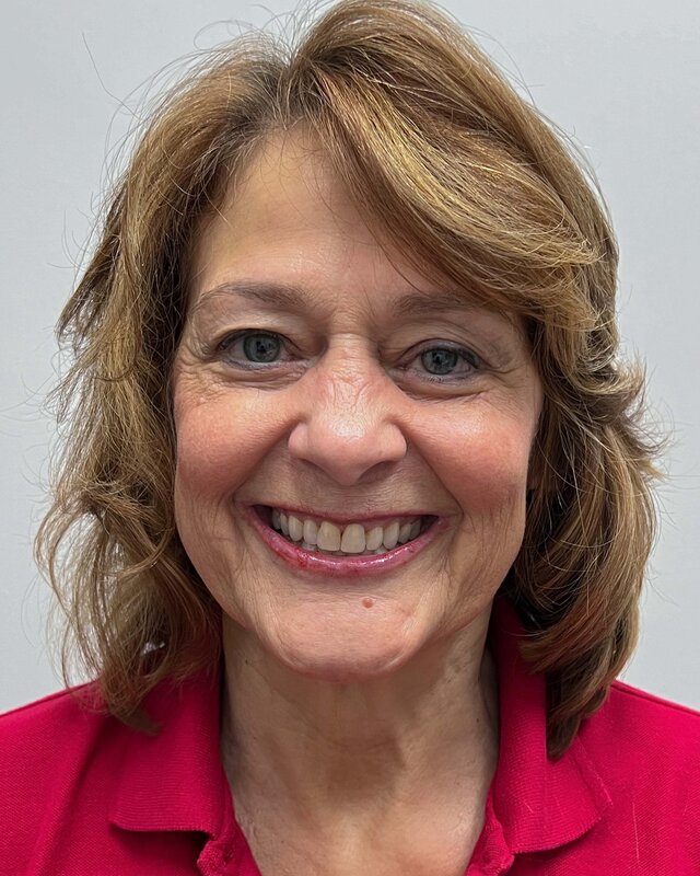 Facelift Before & After Image