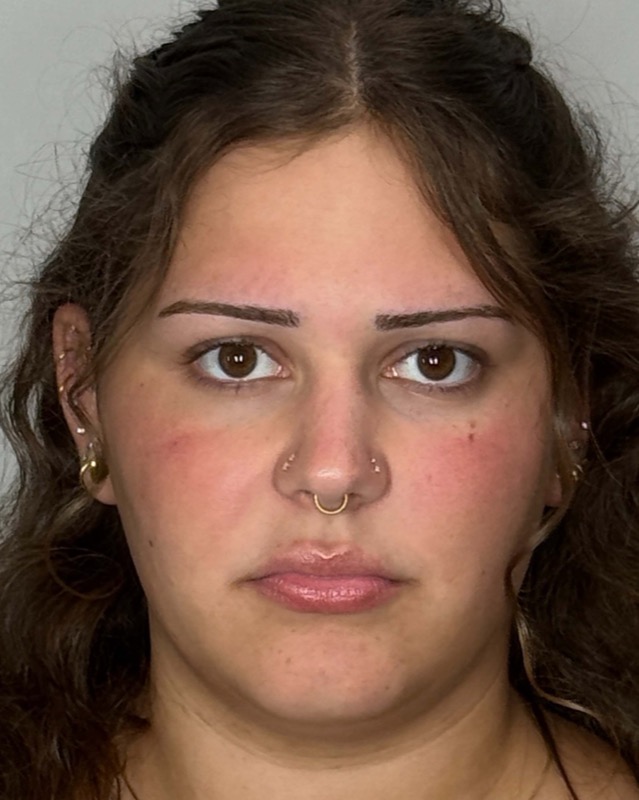 Juvederm Before & After Image