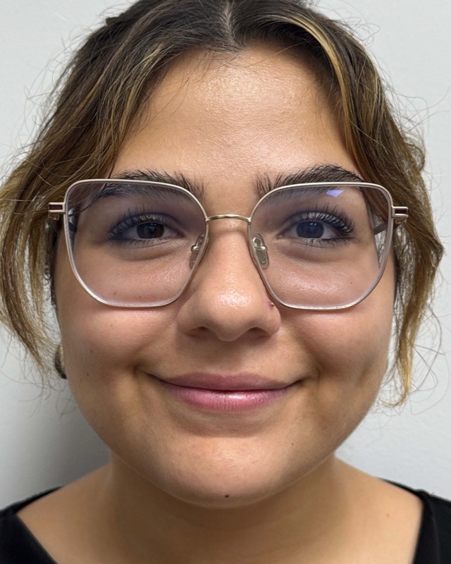 Juvederm Before & After Image